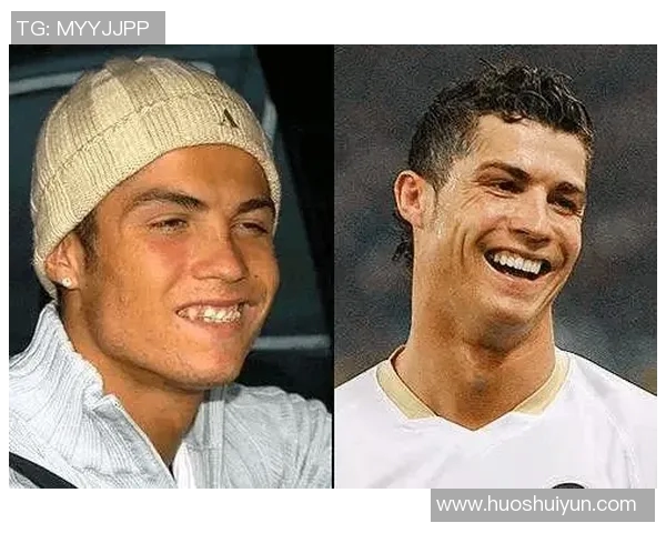 足球明星整牙的原因揭秘提升形象与职业生涯的双重价值